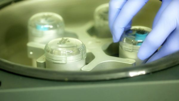 autologe mesotherapeia prp autologe mesotherapeia prp